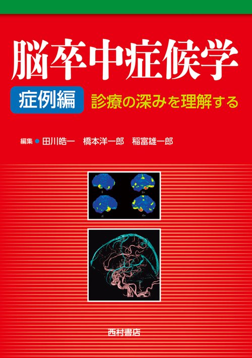 脳卒中症候学 症例編