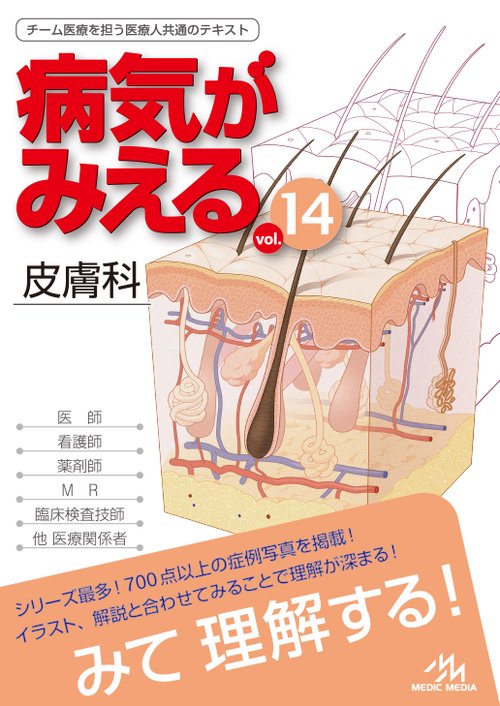 病気がみえる vol.14