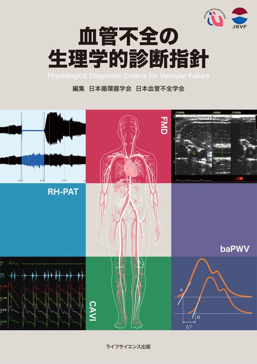 血管不全の生理学的診断指針
