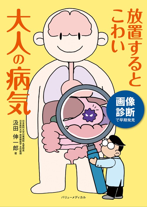 画像診断で早期発見　放置するとこわい大人の病気
