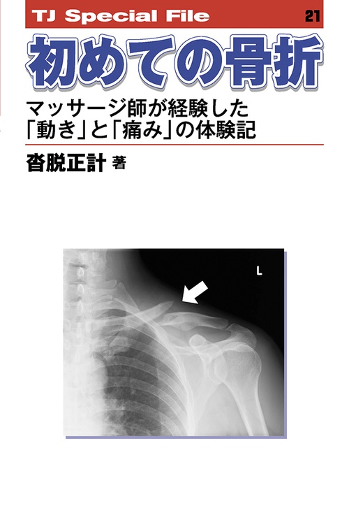 初めての骨折──マッサージ師が経験した「動き」と「痛み」の体験記 TJ SPECIAL FILE 21