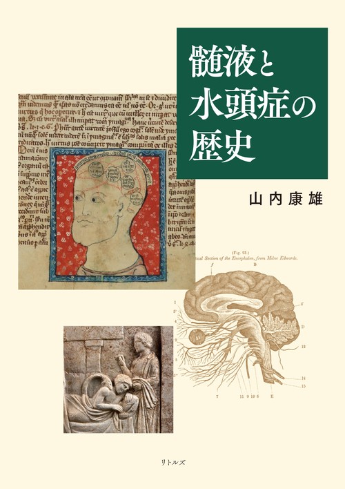 髄液と水頭症の歴史