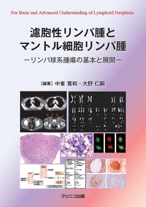 濾胞性リンパ腫とマントル細胞リンパ腫　リンパ球系腫瘍の基本と展開