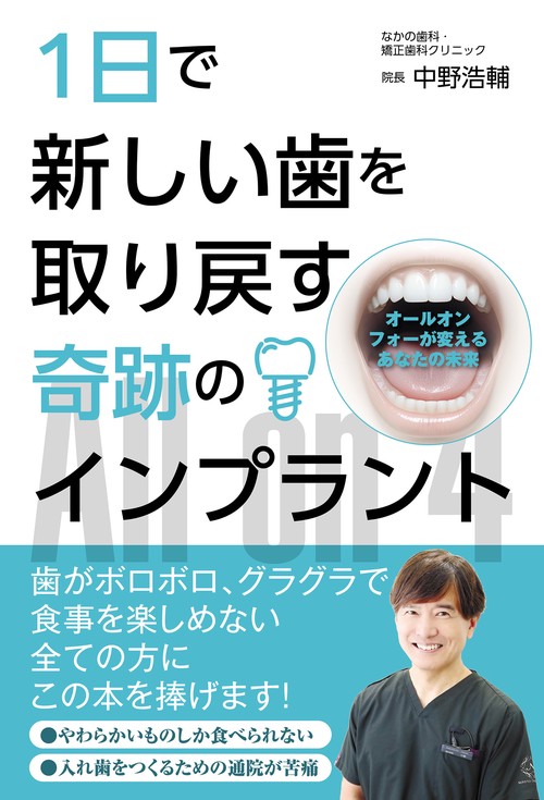 1日で新しい歯を取り戻す奇跡のインプラント オールオンフォーが変えるあなたの未来
