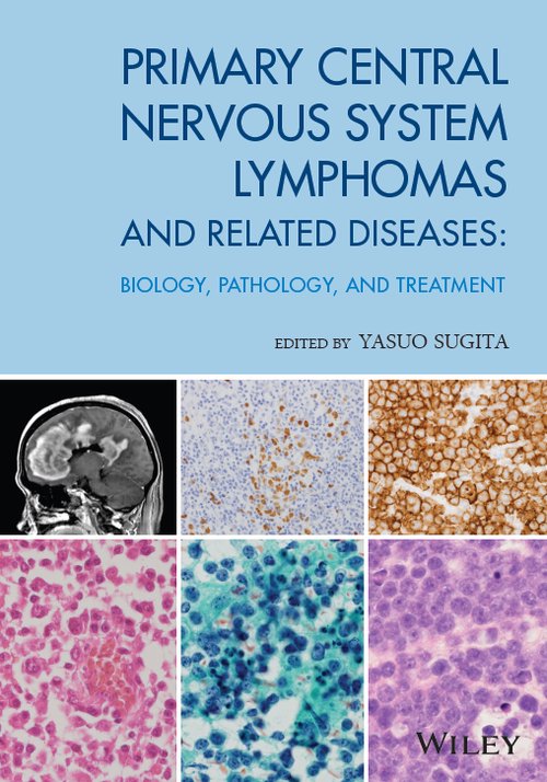 PRIMARY CENTRAL NERVOUS SYSTEM LYMPHOMAS AND RELATED DISEASES BIOLOGY,PATHOLOGY,AND TREATMENT