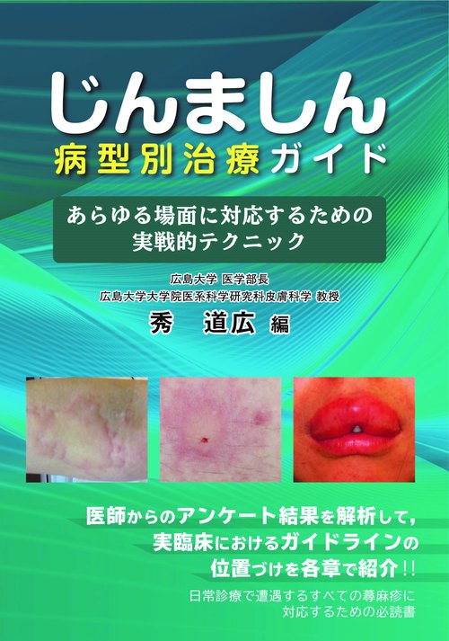 じんましん病型別治療ガイド あらゆる場面に対応するための実戦的テクニック