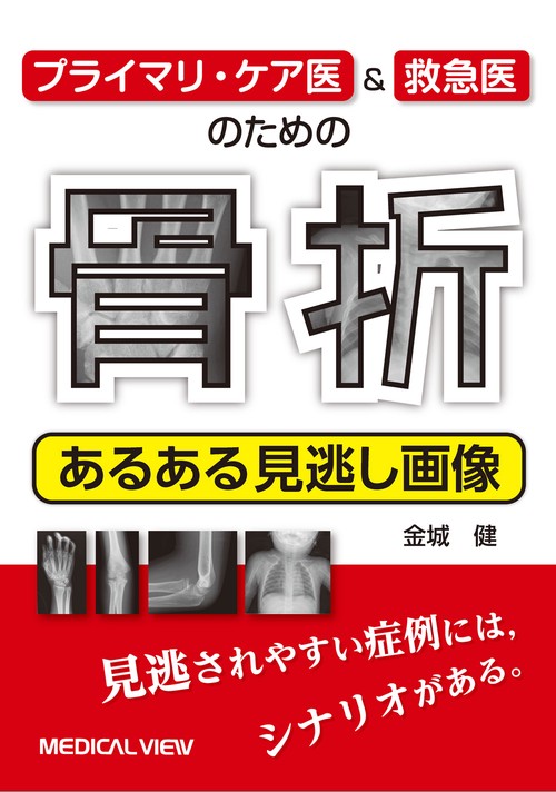 プライマリ・ケア医&救急医のための 骨折 あるある見逃し画像