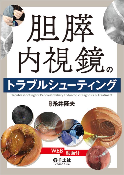 胆膵内視鏡のトラブルシューティング – 丸善ジュンク堂書店