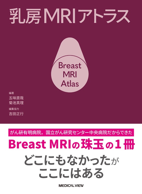 乳房MRIアトラス – 丸善ジュンク堂書店ネットストア 乳房MRIアトラス – 丸善ジュンク堂書店ネットストア
