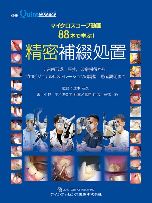 マイクロスコープ動画88本で学ぶ！ 精密補綴処置 – 丸善ジュンク