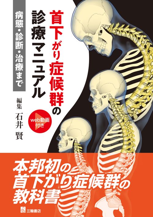 首下がり症候群診療マニュアルー病態・診断・治療まで – 丸善 首下がり症候群診療マニュアルー病態・診断・治療まで – 丸善
